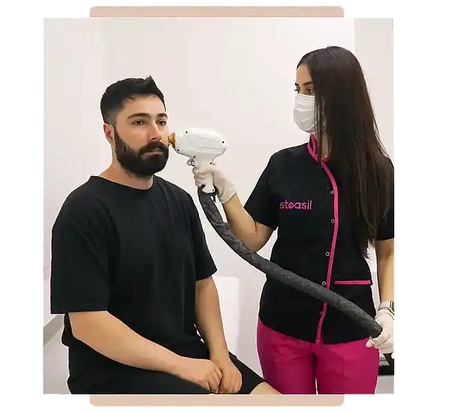 Erkek Lazer Epilasyon