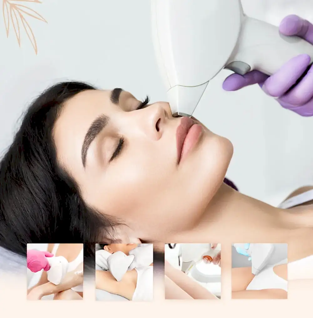 Kadın Lazer Epilasyon Uygulama Bölgeleri Kadın Lazer Epilasyon Uygulama Bölgeleri