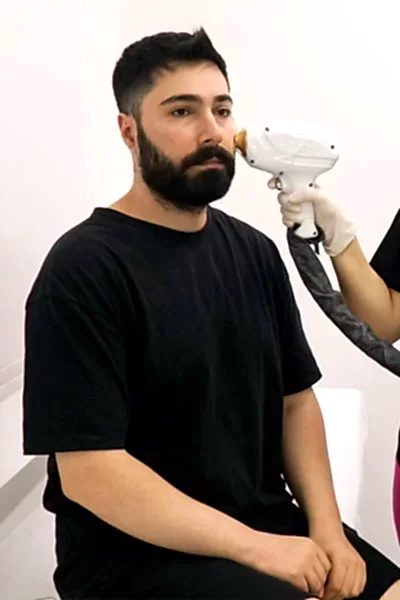 ERKEK LAZER EPİLASYON